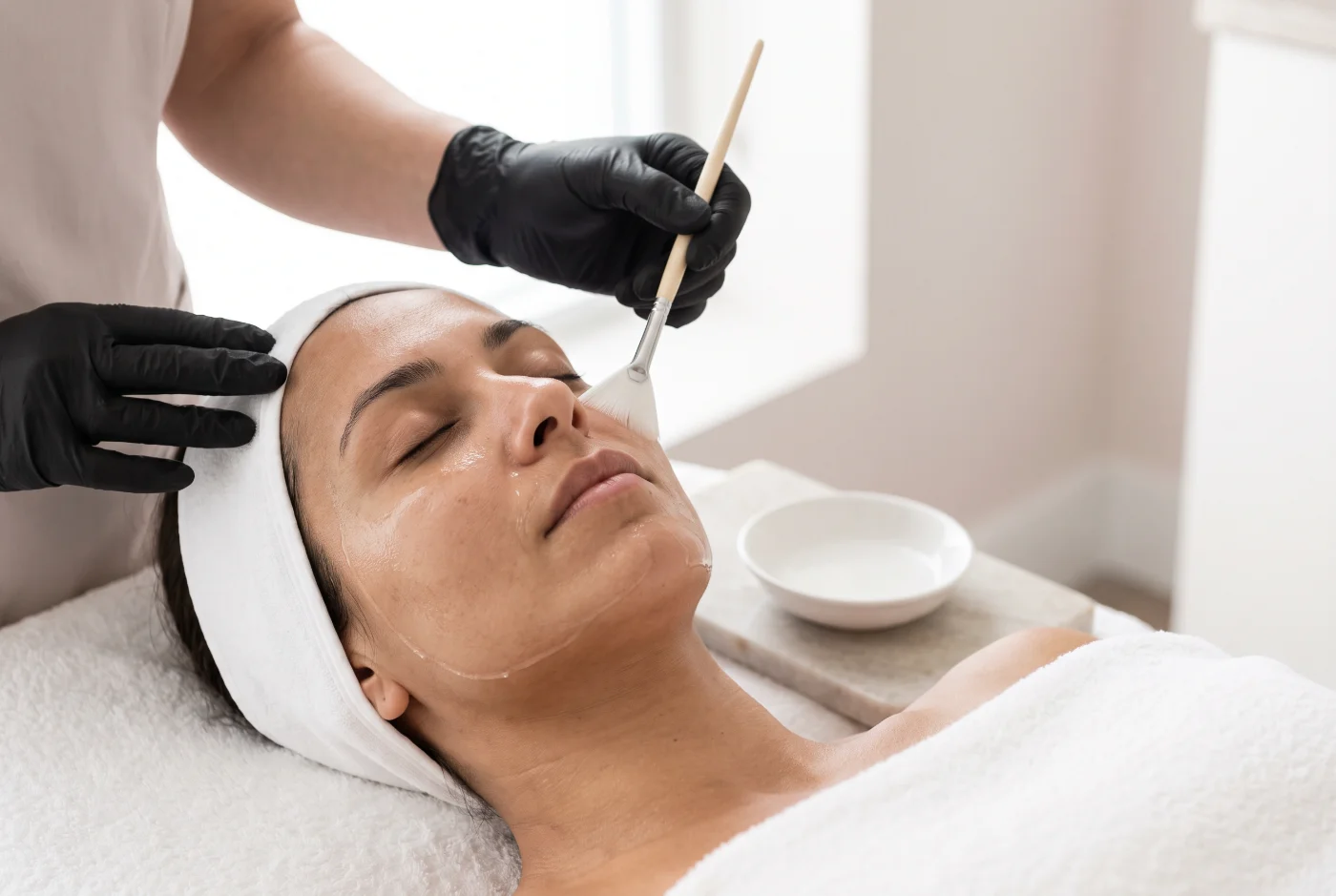 A peel solution being brushed across a client's cheek in a bright treatment room